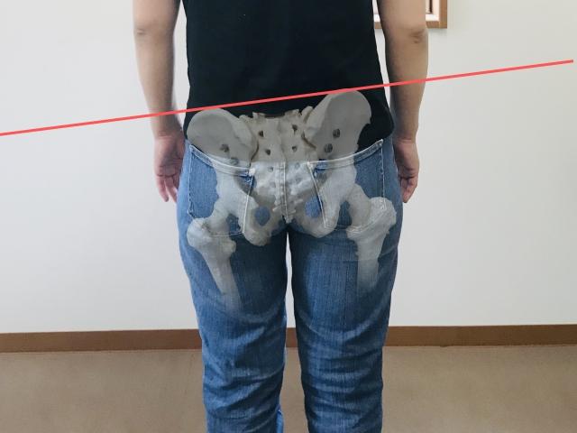 骨盤の傾き